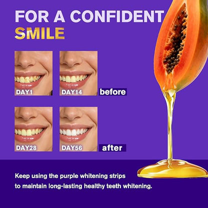 Teeth whitening Strips
