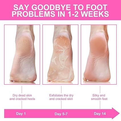 Niacinamide Foot Masks