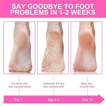 Niacinamide Foot Masks