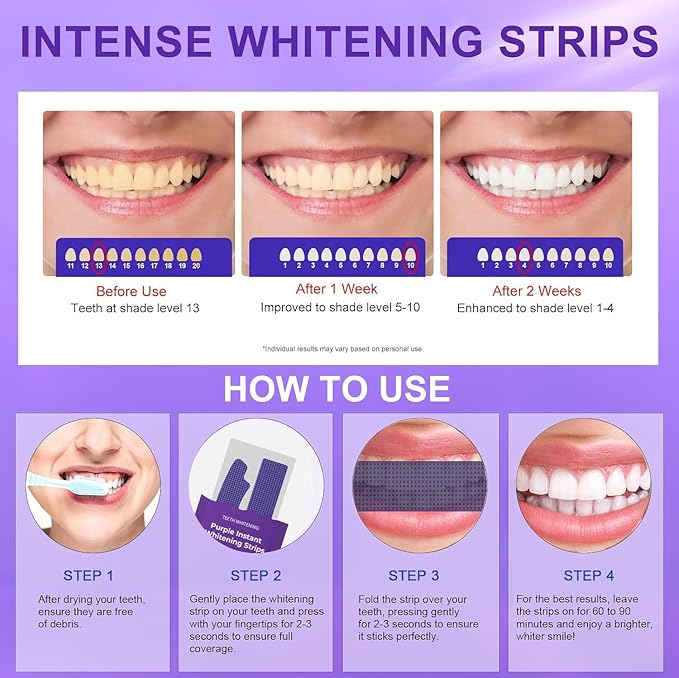 Teeth whitening Strips