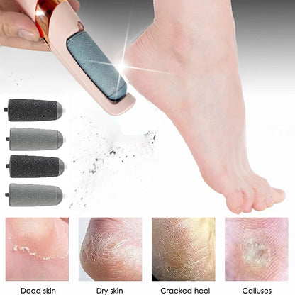 Foot File Callus